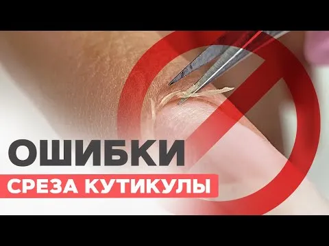 Почему от лака желтеют ногти 7