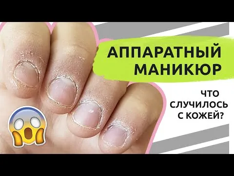 Что произошло с кожей? Аппаратный маникюр