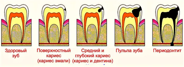 Как понять что стоматолог плохой 3