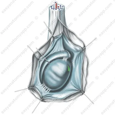 Привесок яичка (appendix testis)