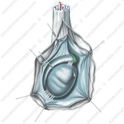 Привесок придатка (appendix epididymis)